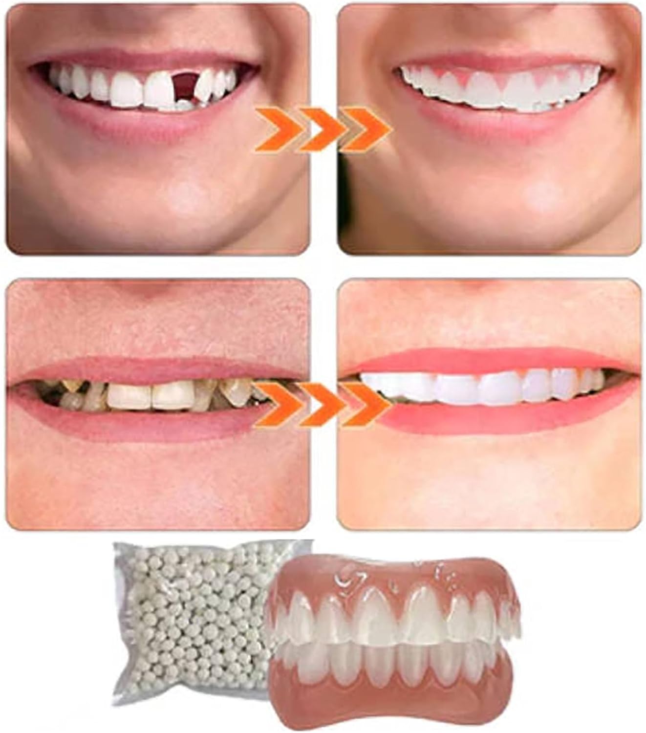 Denture Silicone Reline Kit Upper and Lower Set D1386