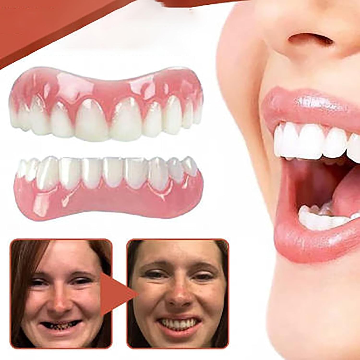 Denture Silicone Reline Kit Upper and Lower Set D1386
